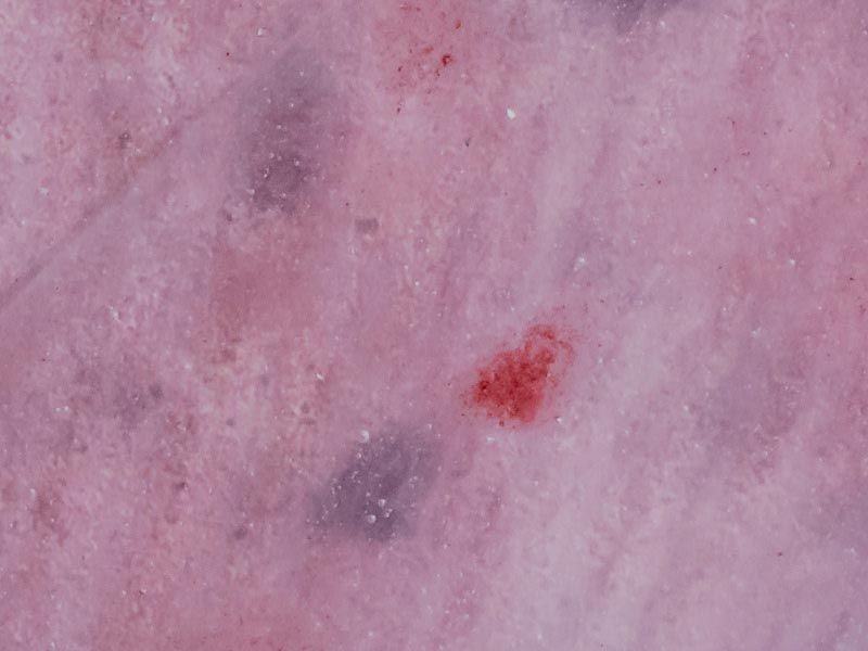 An abstract pink, red, and purple pattern demonstrating a microspic infection