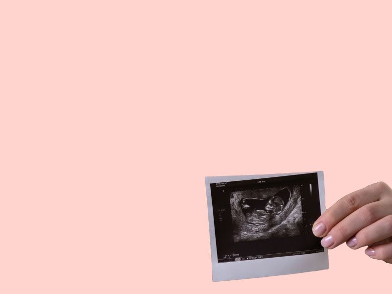 A pregnant woman holding a sonogram picture with a peach-colored background