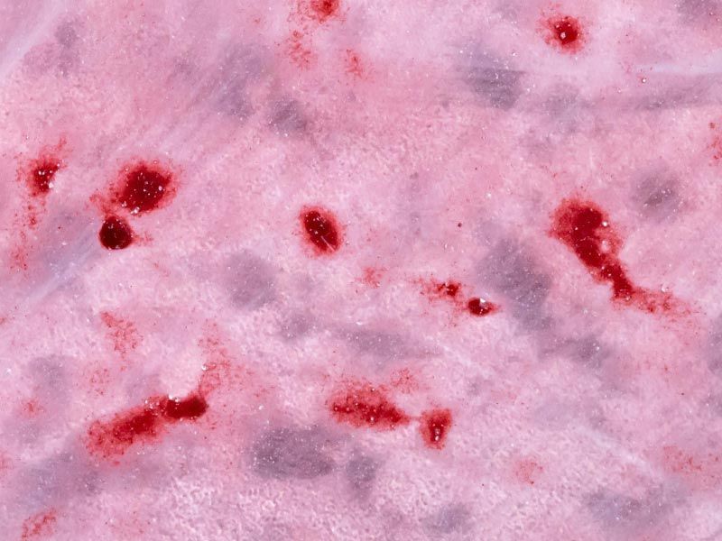 An abstract pink, red, and purple pattern demonstrating a microspic infection