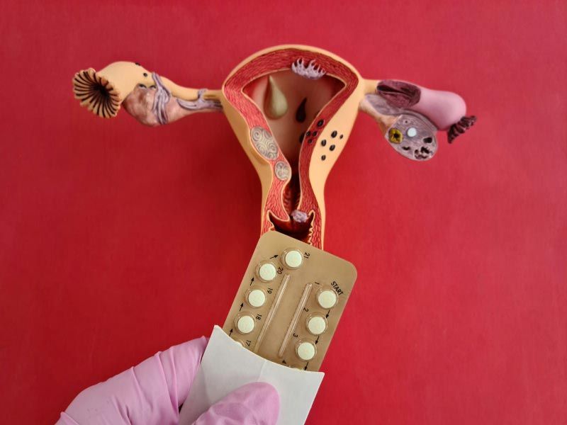 A reproductive organ diagram with a a person's hand holding a birth control packet on a dark red surface