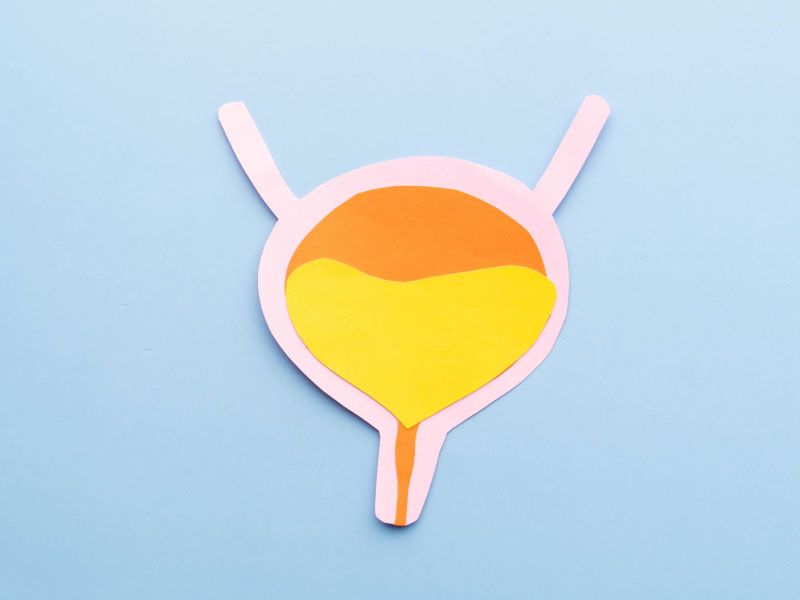 An orange and yellow paper cut out of a bladder on a light blue background