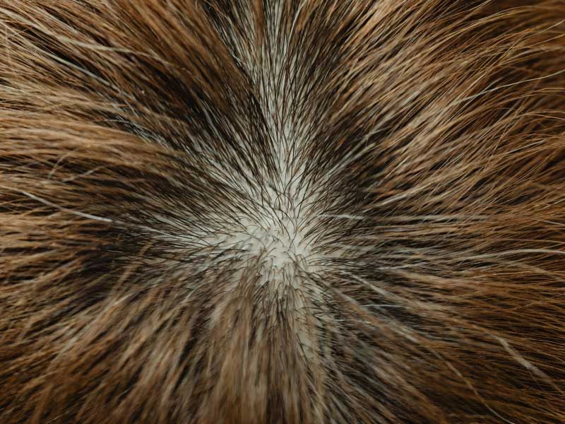 The top of a person's head showing an area of hair thinning