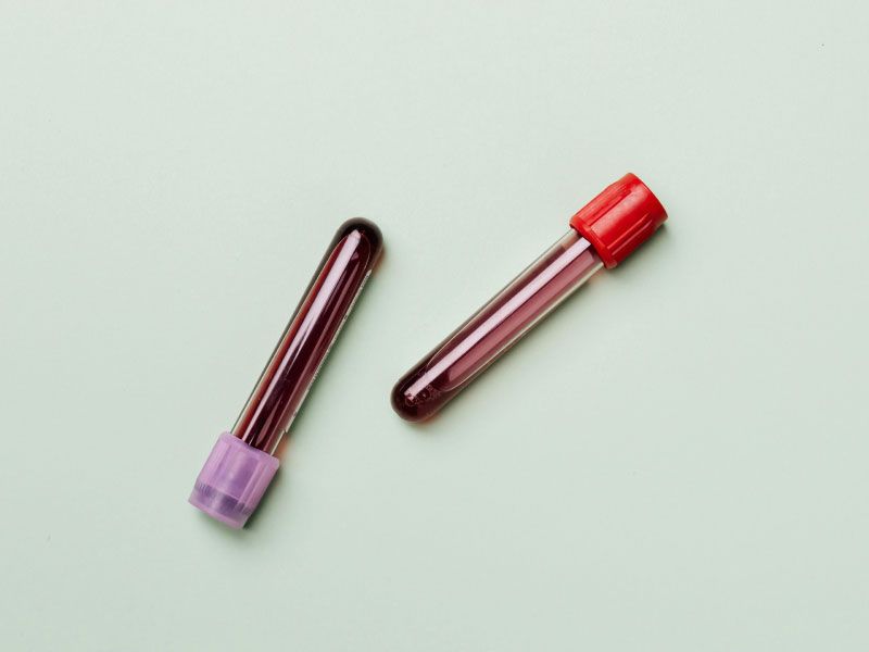 Two vials of blood with red and purple lids on a light green surface