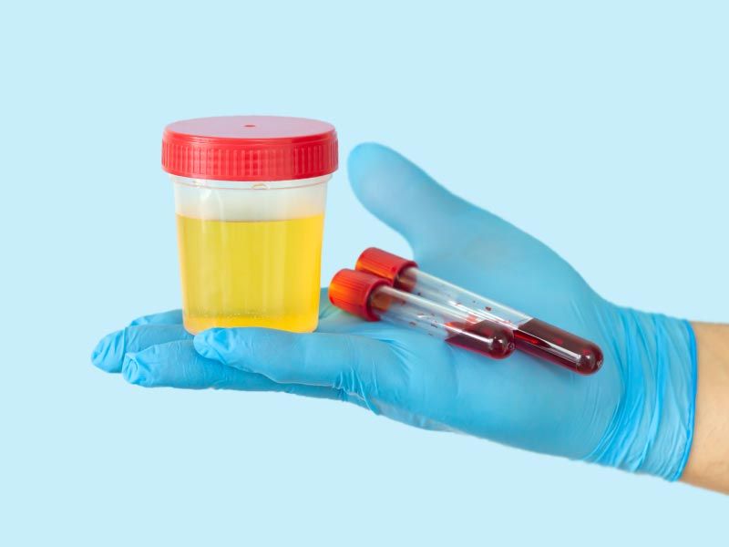 A gloved medical professional's hand holding test tubes and a urine sample cup in front of a light blue background