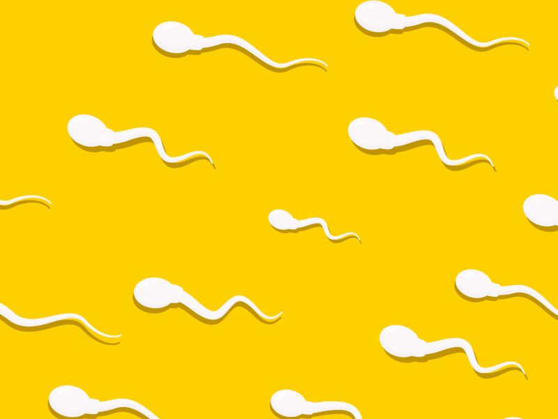 Swimming sperm shapes on a yellow background