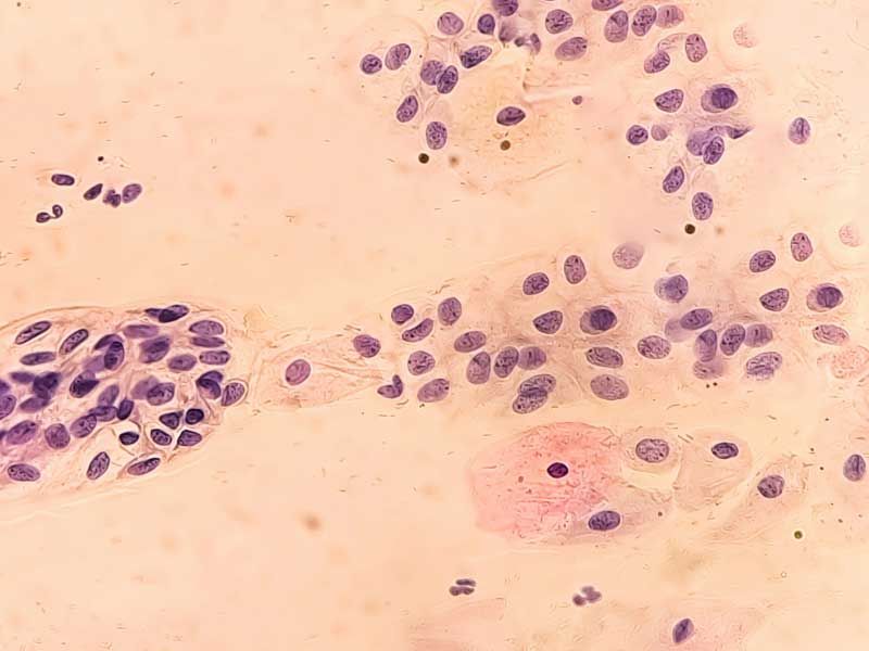 Microscopic pathology of fungus and bacteria for vaginal health treatment