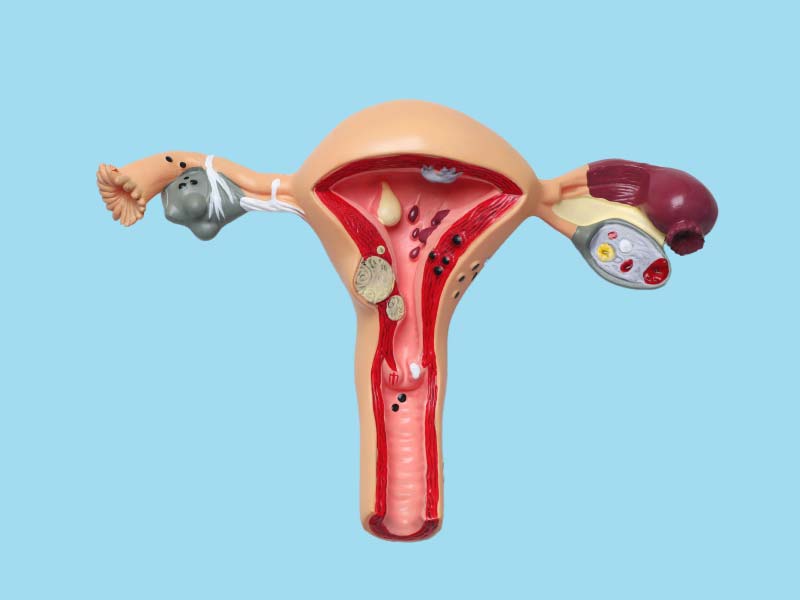 A 3-dimensional diagram of female reproductive anatomy