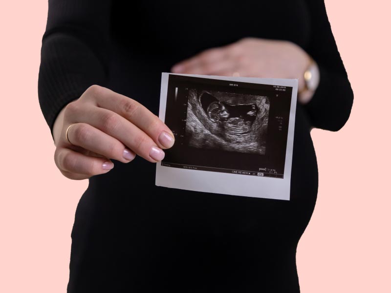 A pregnant woman holding a sonogram picture with a peach-colored background