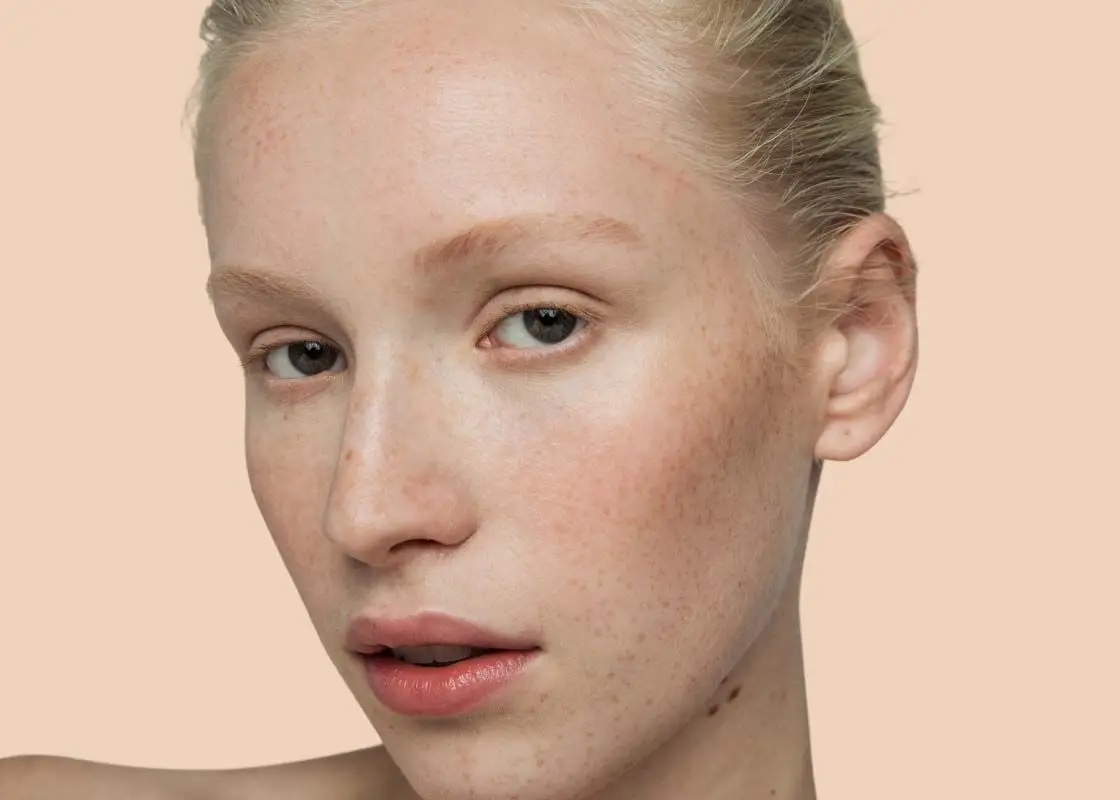 A close up of a fair skinned woman with freckles in front of a cream background